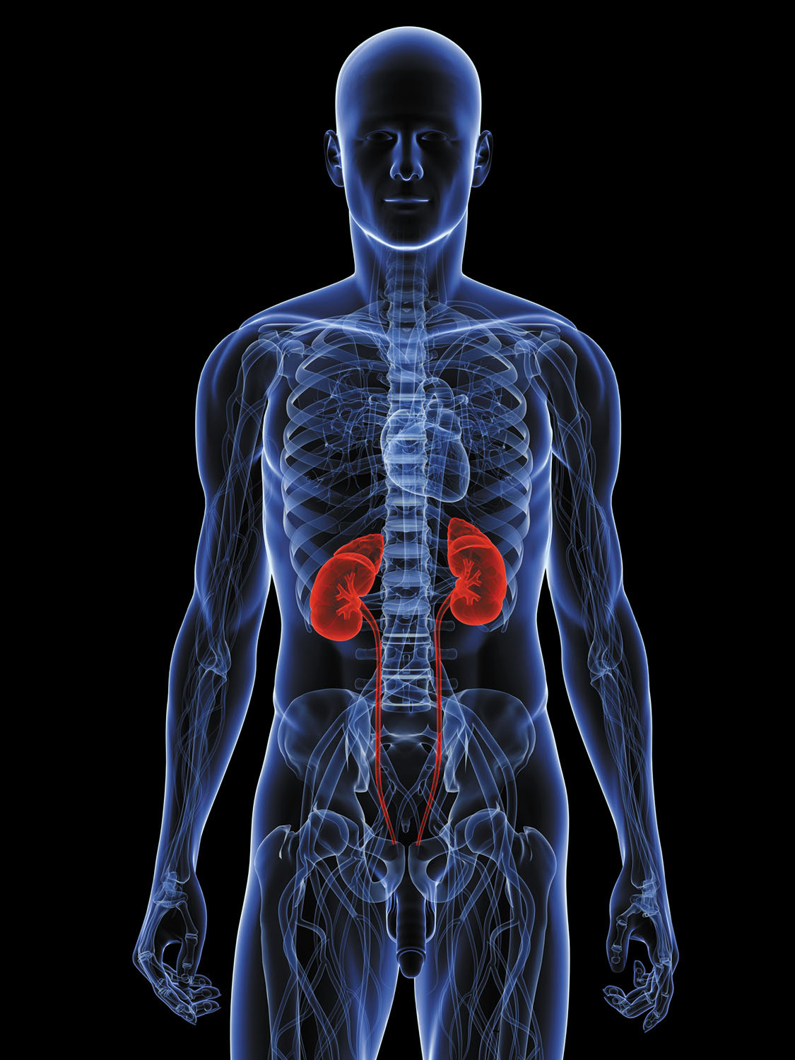 Is my kidney causing my back pain?