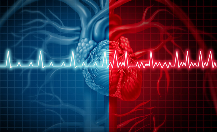 What Does Abnormal Heart Rhythm Mean