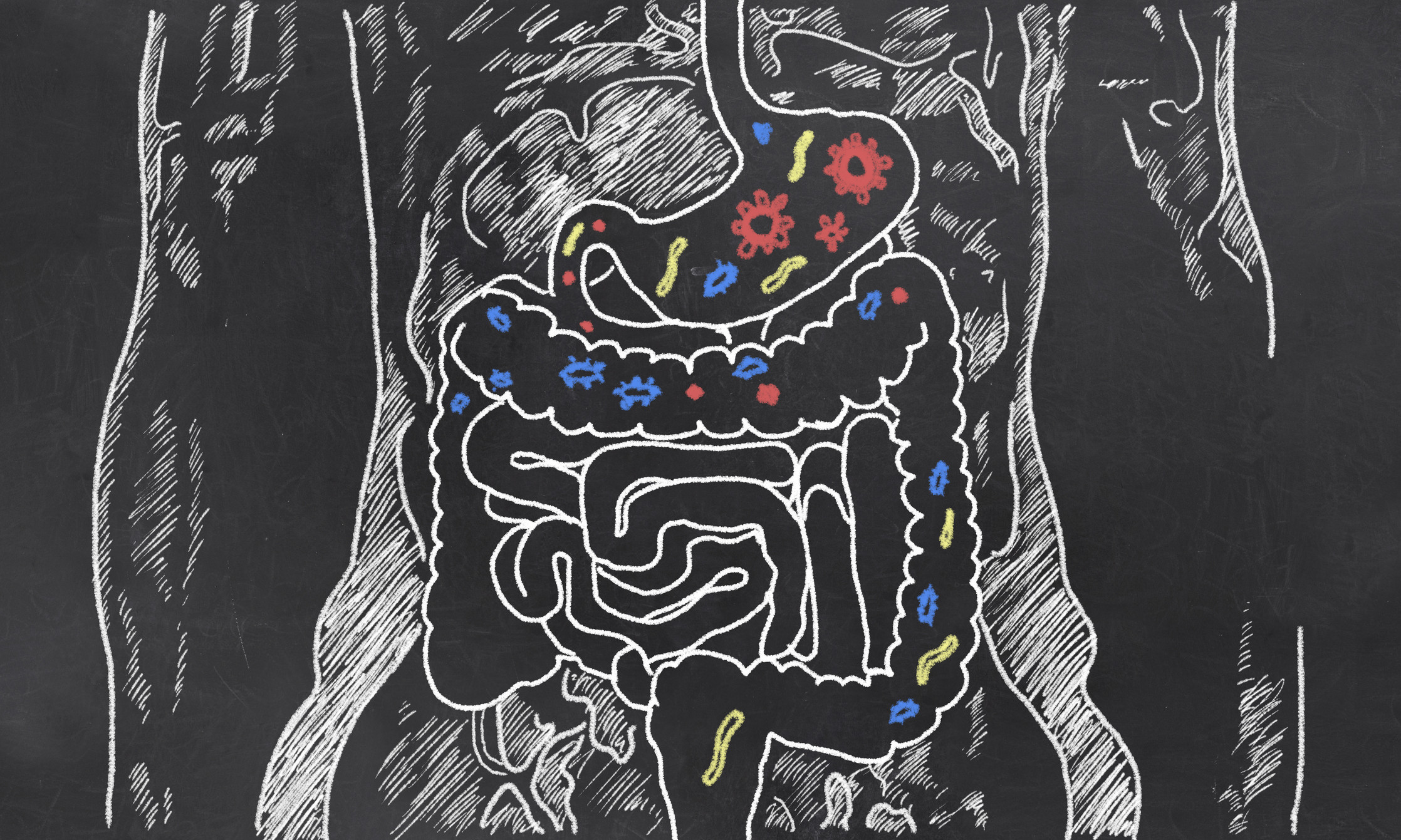 Leaky gut: What is it, and what does it mean for you? - Harvard Health