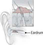 Got an ear full? Here's some advice. - Harvard Health