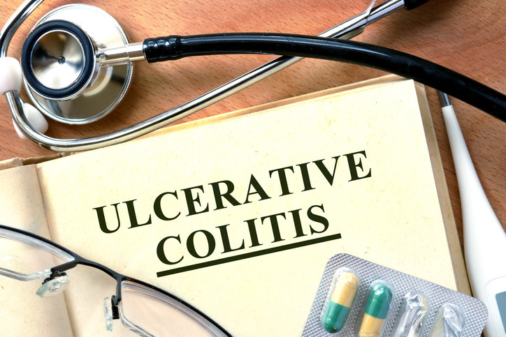A notepad with "ulcerative colitis" printed on it and a stethoscope laying next to it. 