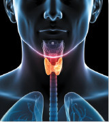 3d rendered illustration of a thyroid cancer