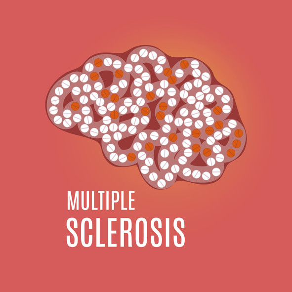 Multiple sclerosis, conceptual illustration