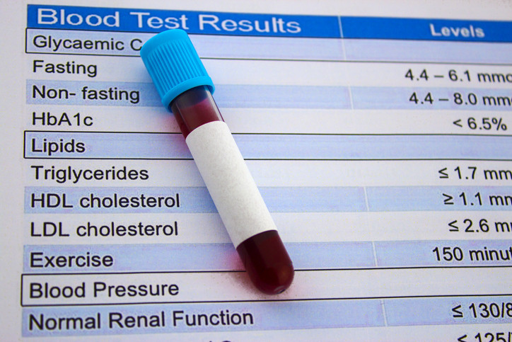 Cholesterol and blood pressure test results with a vial of blood sitting on top of it. 