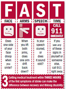 FAST - Identify a stroke FAST chart