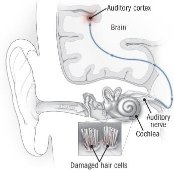 illustration of ear and auditory pathway to brain