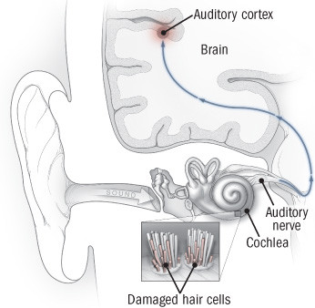 Ringing in left on sale ear and pain