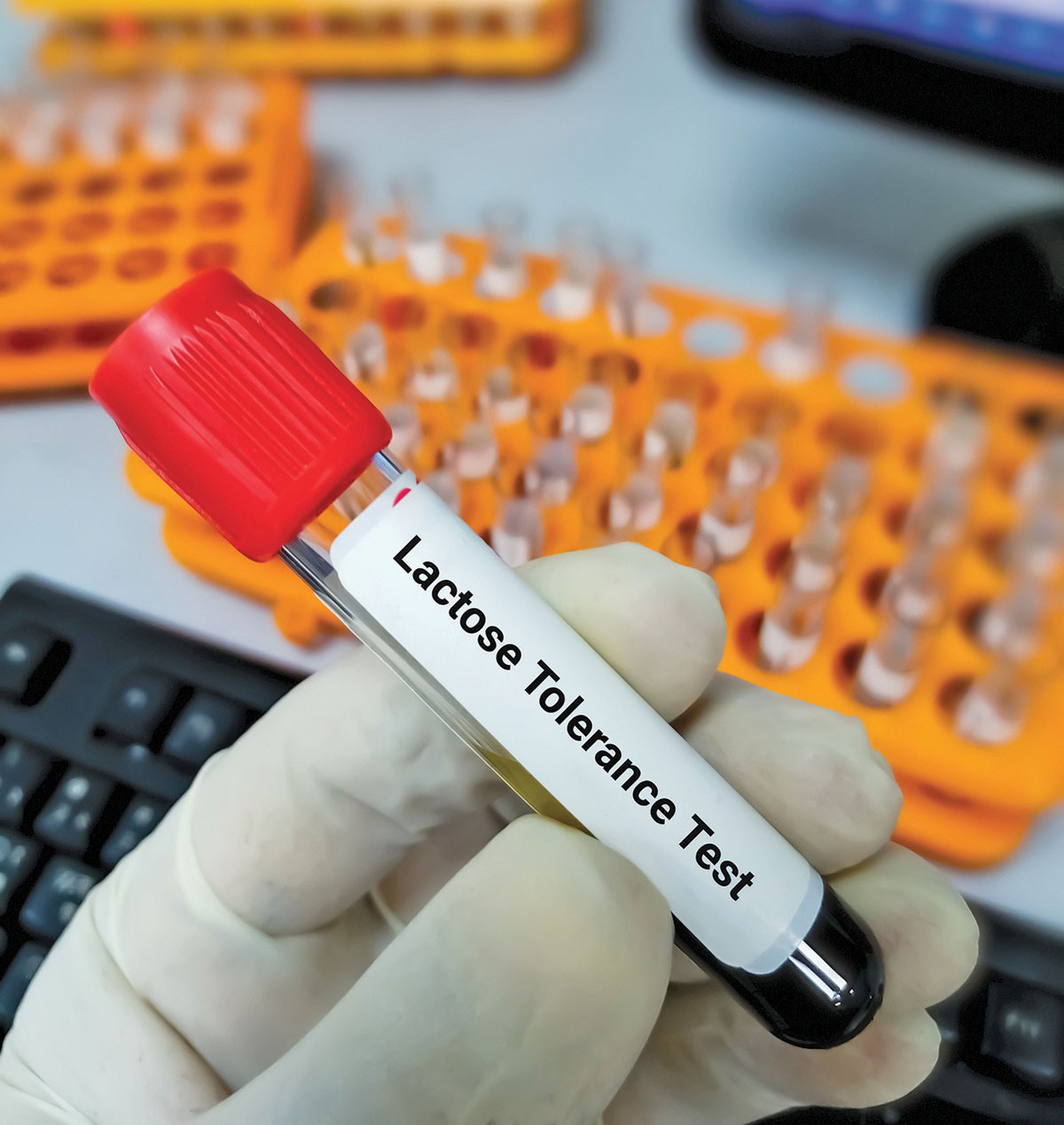 photo of a gloved hand holding a tube labeled lactose tolerance test