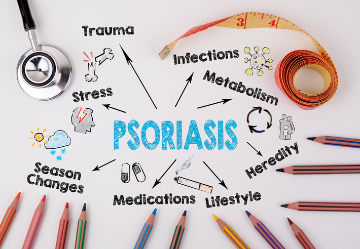 A white board with the word 'psoriasis' surrounded by some potential triggers and treatment
