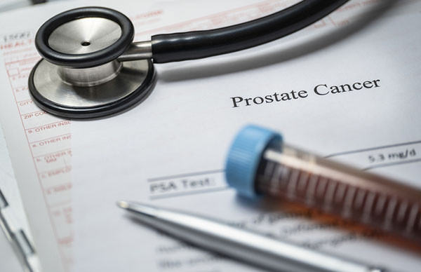 Tightly cropped photo of a sheet of paper showing prostate cancer test results with a blood sample tube, stethoscope, and a pen all resting on top of it