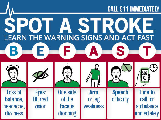 graphic showing how to recognize the signs of a stroke, using the acronym BE FAST as described in the article