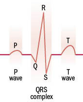 illustration of a normal heartbeat as shown by an ECG test