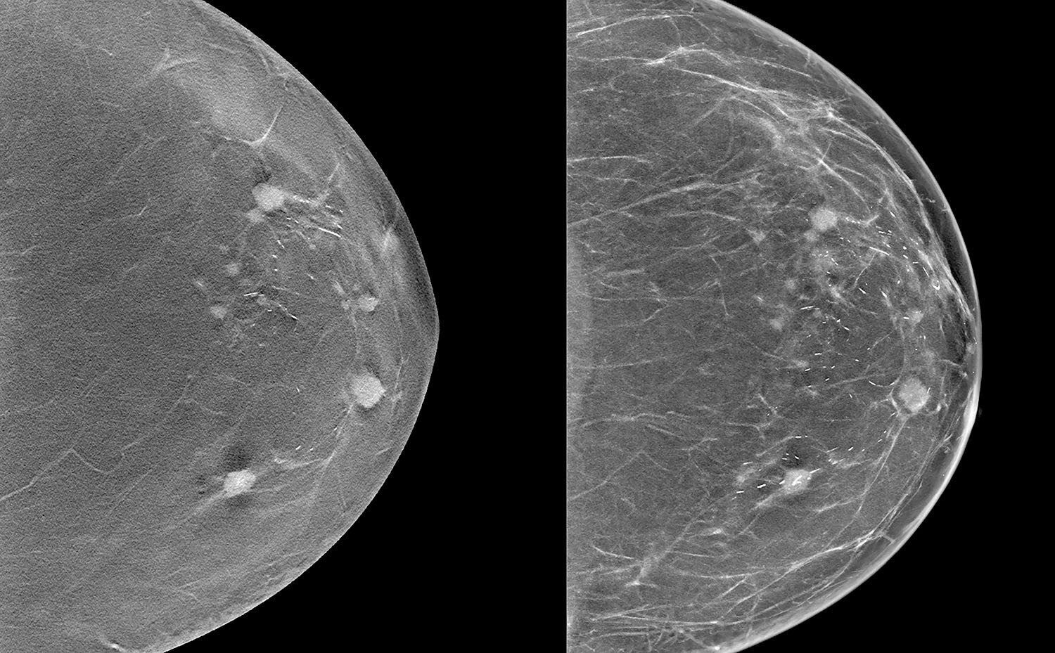 images from a three-dimensional mammogram scan