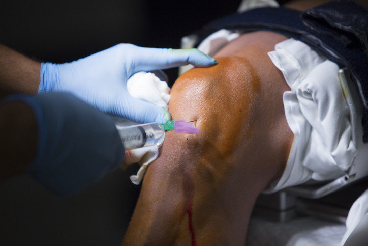 photo of a doctor injecting a needle into a patient's knee