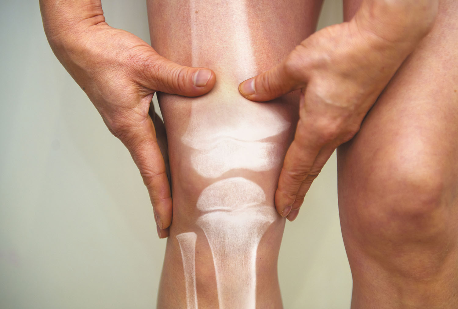 photo illustration of a man's leg showing the bones superimposed on the skin