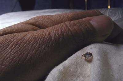 A close-up of a bed bug approaching a person's hand.