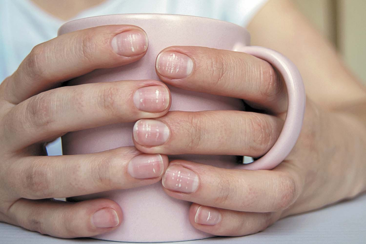 close-up photo of a woman's hands holding a mug; her fingernails have white spots