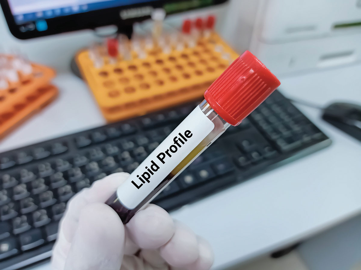 photo of a tube of blood for testing, held by a gloved hand and labeled lipid profile