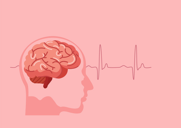 Scientific medical illustration of human brain stroke illustration.