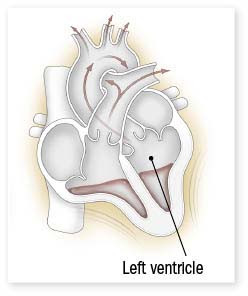 cutaway illustration of the heart with a callout pointint to the left ventricle