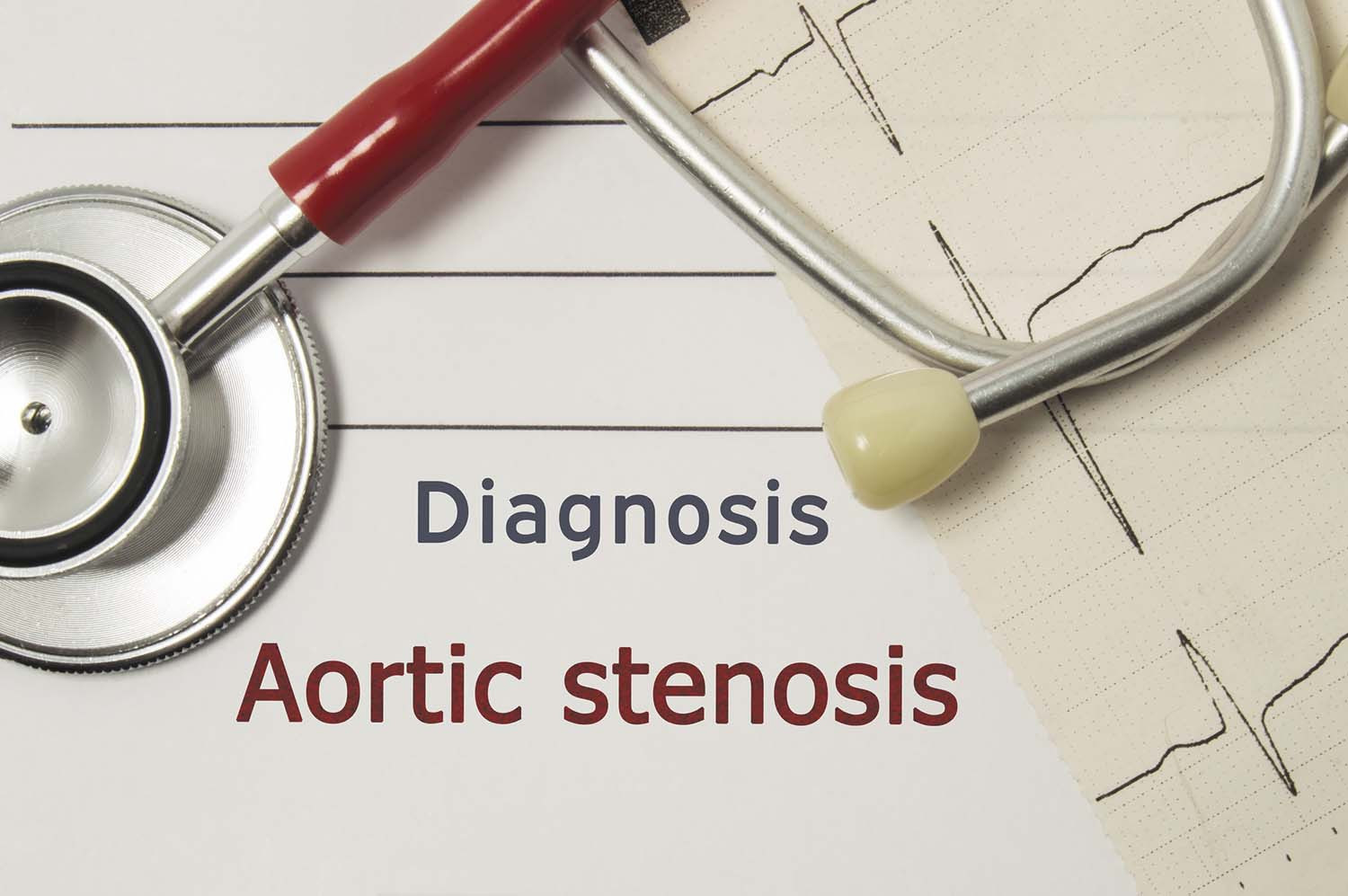 photo of a stethoscope resting on a piece of paper with the words "diagnosis aortic stenosis"
