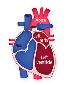 illustration of a heart in shades of red and blue with callouts for the aorta, left atria, and left ventricle