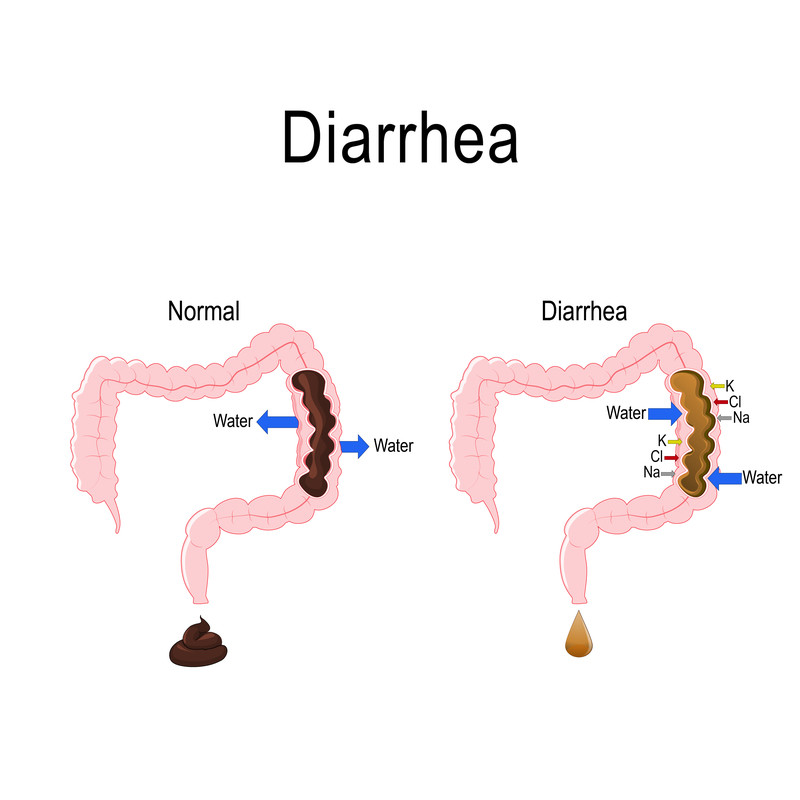 What Can Cause Diarrhoea For Months