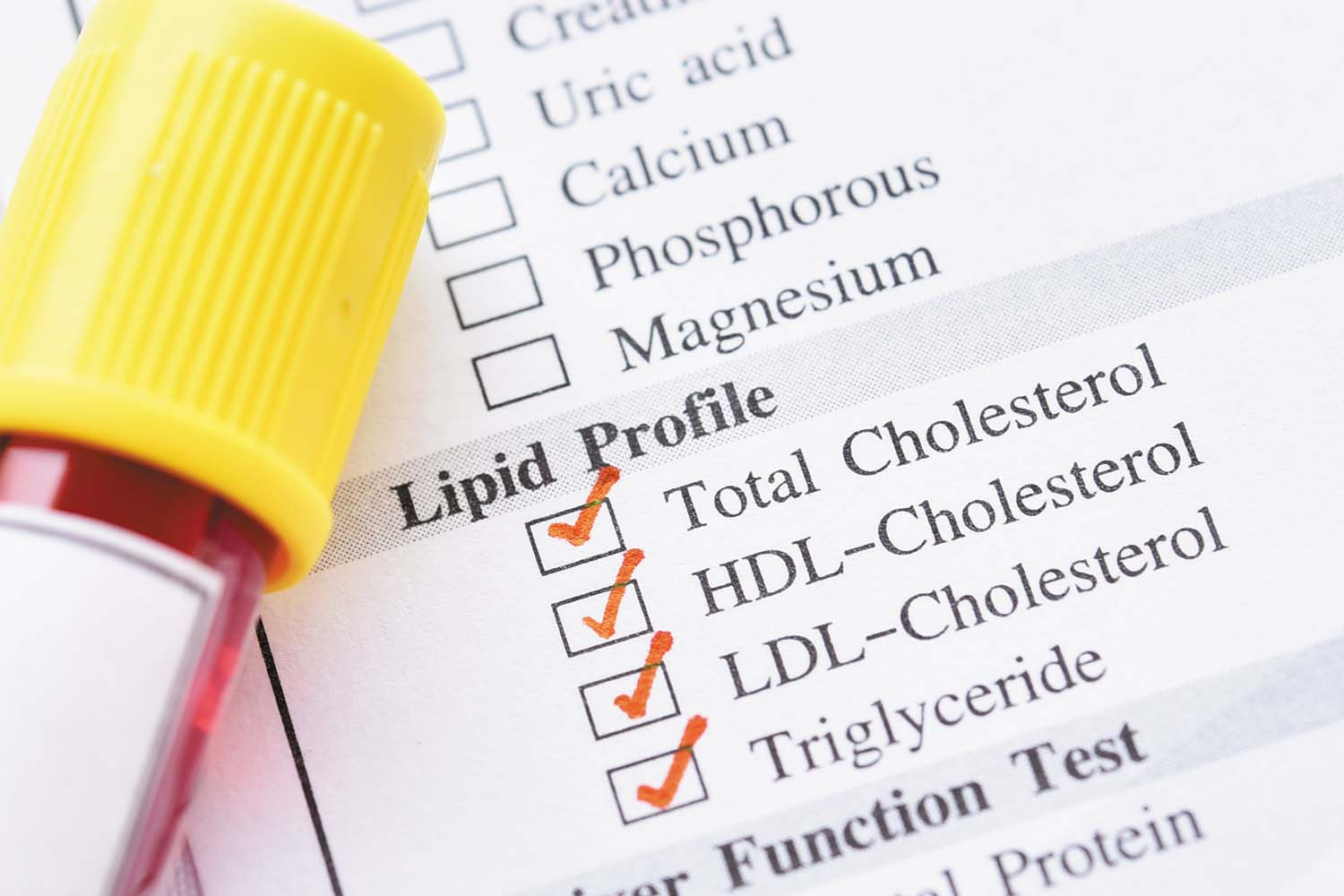 photo of a vial of blood with a yellow cap resting on a piece of paper with check marks next to lab requests for various types of cholesterol