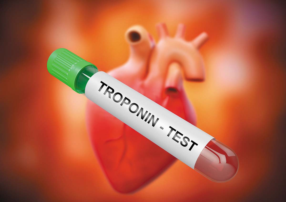 illustration of a vial of blood labeled troponin test floating in front of a rendering of a heart