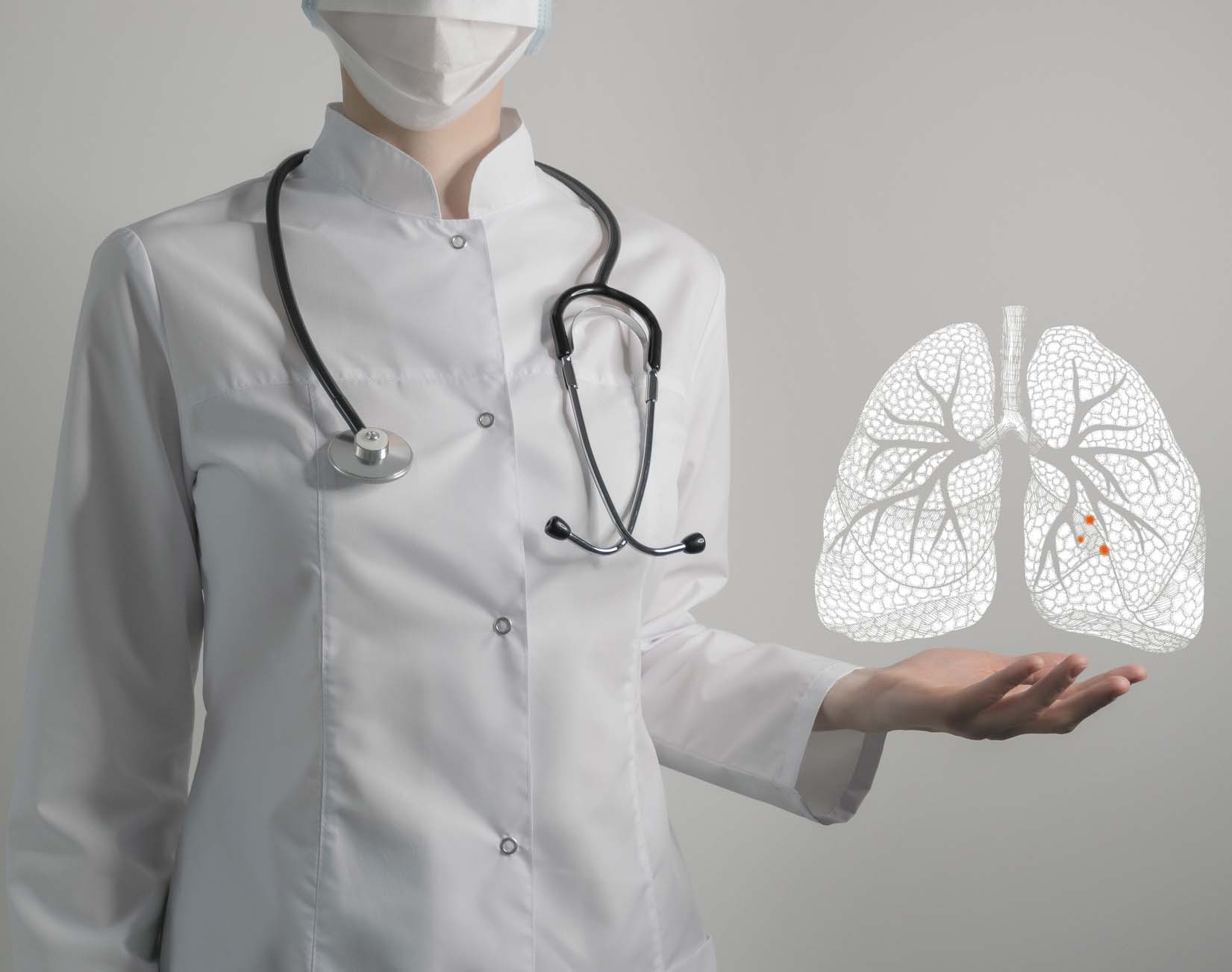 photo illustration of a doctor holding out a hand; floating above it is a pair of lungs with red spots in one lung representing cancer