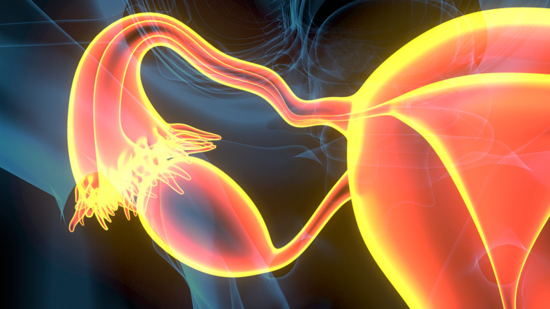 3-D graphic of female reproductive system showing a fallopian tube and ovary and part of the uterus in orange and yellow